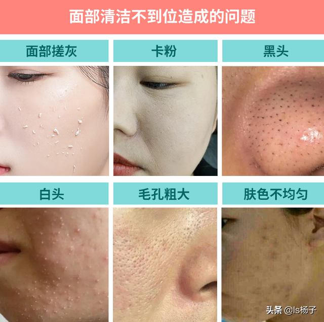 脸部太脏自己在家怎么做深层清洁脸部，面部清洁的七个流程（精）