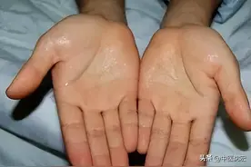 “手心多汗，全身大乱”是什么原因？送你5个中成药，可收涩止汗图片