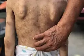 令人发指！7岁女童被奶奶用老虎钳弄出血，为何被亲人毁了一生？图片