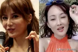 娱乐圈“假下巴”太多了！女星男星都有，下巴又尖又翘似蛇精图片