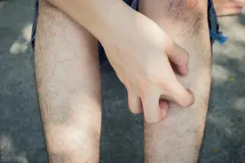 双腿反映全身病，千万要留意！腿上的7个疾病信号，看你自查有吗图片