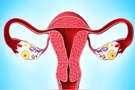 年轻女子体检过程中，发现子宫内有毛发和黏稠物，什么原因引起的图片