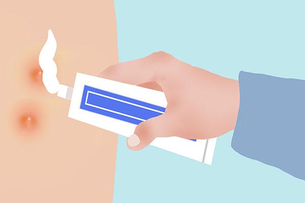 毛囊炎皮肤毛周角化症怎么治