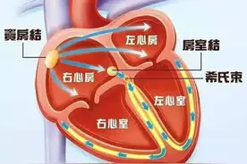 为什么会发生心脏早搏？1分钟教你识别最危险的早搏图片