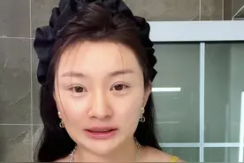 三个月挽救发际线，米诺地尔亲身使用过程分享#分享爱用物图片