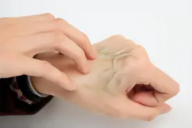 洗澡后身上出现密密麻麻的水泡，怕患癌？皮肤癌的早期表现别忽视图片