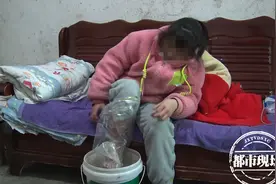 九江：14岁少女患怪病，双脚烫得像火烧，冬天必须泡冰水降温图片