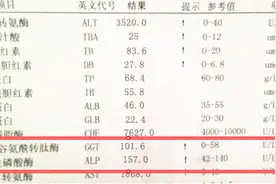 肝功能检查，谷氨酰转肽酶和碱性磷酸酶升高的意义是什么？图片