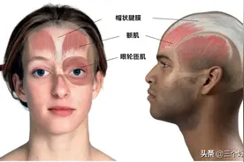每日一肌：额肌，头部肌肉，主要功能是提眉或皱额图片