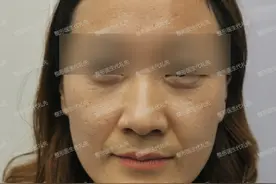 面部衰老的3个标志，出现后注意改善，有助维持最佳年轻化图片