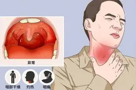 全网都在咽喉炎？除了新冠，还可能因为啥？（附缓解方法）图片