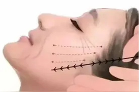 害怕线雕的小伙伴，看看这个你就知道了图片