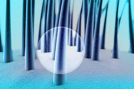 头皮上抠下来的小颗粒，到底是什么？图片