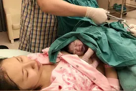 剖腹产注意事项，做好这几点减掉90%痛苦图片