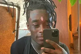 太吓人！脑门镶钻被粉丝硬抠掉，头骨钻开挂金链子，rapper都疯了图片