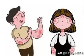 胳膊对称红斑 不疼不痒图片