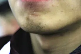 男性步入中老年，雄激素变低会怎么样？饮食搭配运动，补回雄激素图片