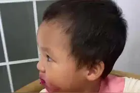 火龙果的危害图片