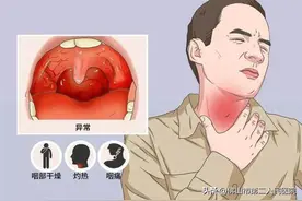 “全国都在咽喉炎”冲上热搜，市二专家告诉你到底该如何处理？图片