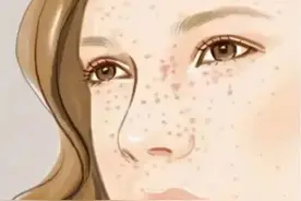 脸上爱长斑，体内必有寒，一盒中成药，散寒消斑，还你美丽容颜图片