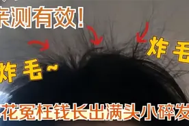在家如何防脱生发？跟着过来人从这两个方面入手，发量暴增！图片