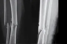 @太原人，好儿郎，去当兵！征兵体检这些事项要注意图片