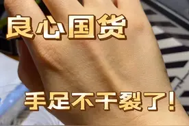 手足干裂，别只盯着“大牌”了！这几样老国货，便宜又好用图片