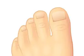 灰指甲难治，偏方才有效？提醒：这个治疗办法才靠谱！记下来图片