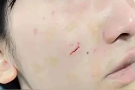 女网红摸狗被咬脸！疑似威胁狗主人：我要抑郁自杀你跑不掉！图片