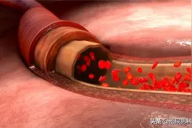 他达拉非药效长达36小时，这种药性对身体健康影响大吗？图片