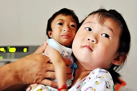 2009年，湖南女子生下重2斤的“猴婴”图片