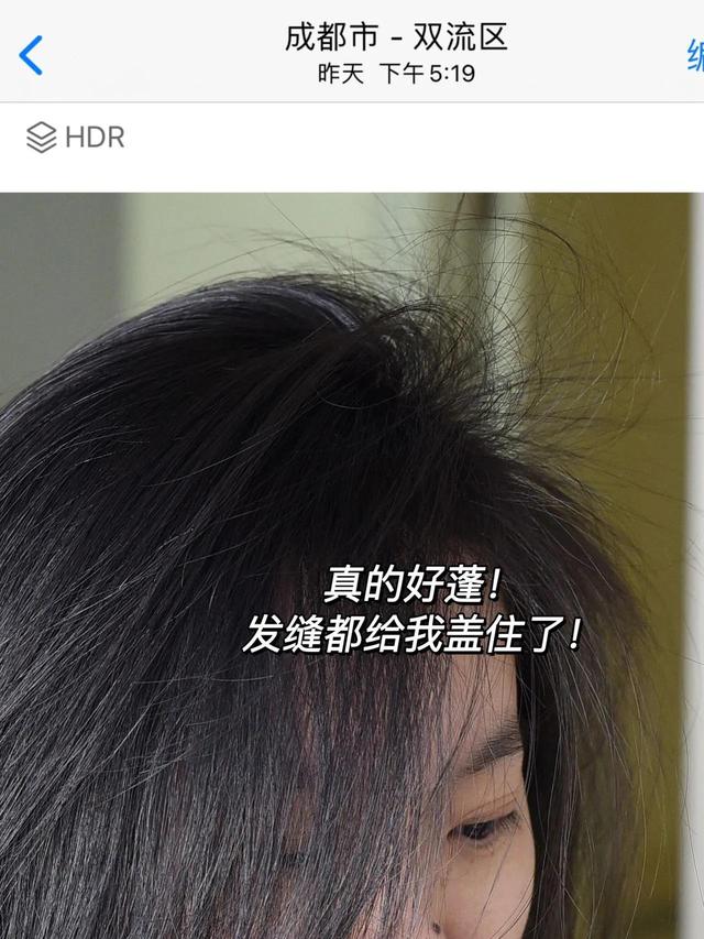 考研党头油掉发，这样洗发缝直接消失