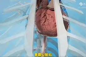 医学动画演示，人工心脏植入过程。图片