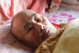 为什么越来越多的人，在70岁之后很快去世？主要原因有二图片