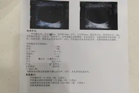 甲状腺结节射频消融术后两年两个月图片