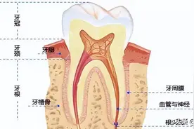 牙没了想补牙，选烤瓷牙还是种植牙？图片