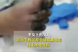 女孩充电被电击内脏受损面临截肢，手机充电正确姿势→图片
