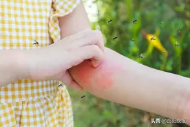 高楼层为什么也有蚊子？ 为什么有的人特别招蚊子“喜欢”？图片