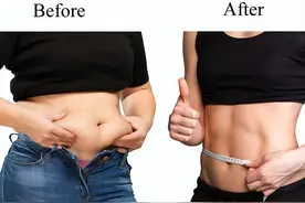 2型是终身疾病？研究发现46%的6年内的糖尿病人可以减肥逆转图片