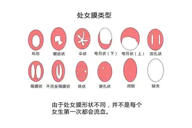关于处女膜，是时候“捅破”真相了图片