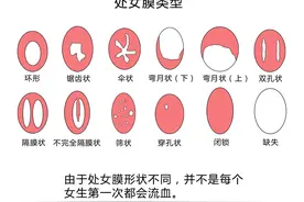关于处女膜，是时候“捅破”真相了图片