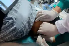 河南省医版VR项目“唯爱丝”演练开路，高难度手术插管分分钟搞定图片