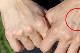 为何有些人手臂“青筋暴起”，有人却看不到“青筋”，看完明白了图片