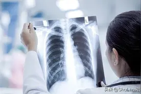 白肺是否会对肺部造成不可逆伤害图片