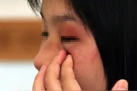 13岁女孩遭霸凌后出现鼓膜穿孔，会带来哪些风险？图片