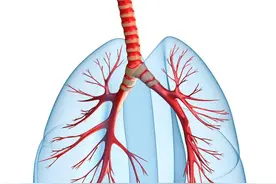 健康早知道：体检查出肺结节，会不会是肺癌？图片