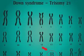 为什么唐氏宝宝遗传不到父母的样貌，感觉长得都一样？图片