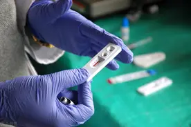 国民每年消费175万盒HIV试剂 A股万孚万泰各领风骚图片