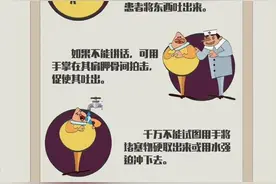 别把异物卡喉当小事！图片