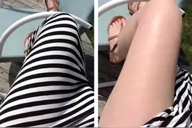 媳妇和领导出差一周回来。看看这个腿，真实心疼得不得了:)图片